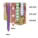 성명시장 | 오큐라 티타늄셀 4.0 내돈내산 후기｜물방울초음파 14일 나노분석 &amp; 비포/애프터 공개