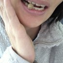 웰빙축산 | GC녹십자웰빙 덴티스텐, 잇몸 건강과 잇몸내려앉음 고민엔 역시 잇몸영양제!