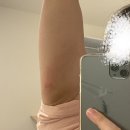 강변역(2) | [서울 강변역 다이어트] RPL 전신 지방 분해 주사 2,3,4회차 후기