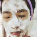 인셀덤 부평대리점에서 여드름, 블랙헤드 피부관리하세요!