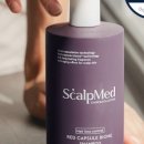 촘촘 스칼프 이미지