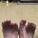 우신향정형외과의원 네이버블로그