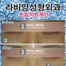 라비앙성형외과의원 이미지