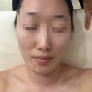 더손맛 | [용인에스테틱] 더블라썸 윤곽관리 후기｜상담부터 손맛까지 만족한 기흥역피부관리