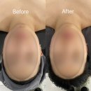 중랑구피부관리 에스테티아 망우역점 드라마틱한 윤곽관리 브이라인턱선 솔직후기