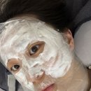 [내돈내산] 점선면의원 루비레이저 • 편평사마귀 제거 시술 직후