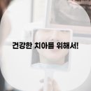 365서울탑플란트치과의원 네이버블로그