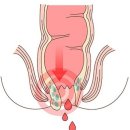 치항병원 이미지
