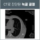 신우탕 이미지