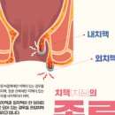 혈변 원인 5가지 및 과 대변 볼때 피 방법 : 치질 대장암 대장염 이미지