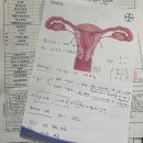 위드산부인과의원 | 최상산부인과 자궁근종 복강경(로봇 X) 수술 후기(1)