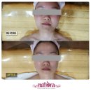람세스피부관리 이미지