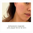 손길2 | 청주윤곽관리 얼굴경락 신의 손길로 부수고 온 후기