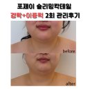 유경순 | [포제이뷰티] 토스카니와 함께하는 일상🍀 / 메조젯건 스팟아웃