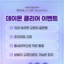 서울루다치과의원 네이버블로그