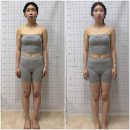 로온체형교정