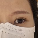 청주 붉은 눈썹 잔흔 제거 개신동 래쉬더롱 1회 만족 후기