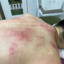 순애 뷰티라인 | 여의도경락 케이뷰티방순애에스테틱 재방문해서 등관리를 받다