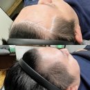 응달말로30 | 남양주두피문신, 다닷SMP만 아는 탈모 커버의 비밀?