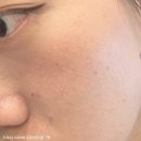 서면피부관리 잘하는곳 예쁘리 아쿠아필 후기