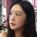 엘리엇의원 | [내돈내산 후기] 엘리엇의원 입술필러 시술받은 후기