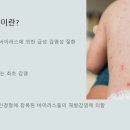 구앤장마취통증의학과피부과의원 네이버블로그