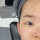 초이스뷰티샵 | [김포/구래] 문제성 피부 맞춤 관리 초이스 뷰티 후기