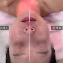 피부의 근본원인까지 잡아주는 부천중동피부관리 란스킨케어 후기