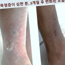 클레오피부관리 네이버블로그