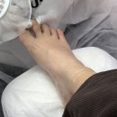 레푸스용산역점 | 용산역 발톱무좀 관리 레푸스 용산역점 방문 후기 서울발톱무좀 관리 추천