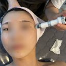 라벨르의원 | 춘천 피부관리 / 퇴계동 피부관리 '라벨르 스킨케어' 물광관리 솔직후기!