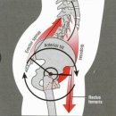 시상면의 자세정렬 특징 및 Sway-Back의 운동처방- 오진 이미지