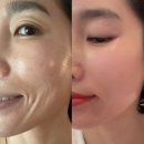 [후기] 피부 광채의 신세계✨ 인셀덤 더마톨로지 부스터 세럼, 직접 써보니 다르네요!