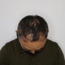 원장님 너무 고맙읍니다...