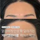 서울대입구 헤어라인 이마 왁싱 통증 없었던 제이엠뷰티룸