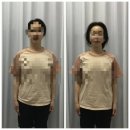 송윤숙 | 부천중동마사지 추천 송윤숙상생약발 후기｜원인 모를 어깨·허리 통증, 상생약발로 관리받고 온 솔직 후기