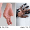 동성 보조기 이미지