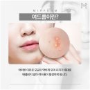 미소지움피부과의원 이미지