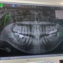 잠실숲사랑니구강악안면외과치과의원 이미지