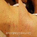 엘에스테틱&왁싱