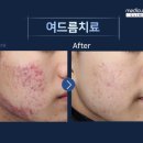 메디큐브의원 네이버블로그