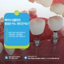 자연드림치과기공소 이미지