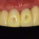 홀치과의원 이미지