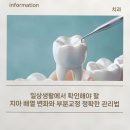 일상생활에서 확인해야 할 치아 배열 변화와 부분교정 정확한 관리법