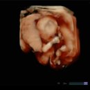 11650-16-173-12 | [임신일기#6] 16주 3일차 아기 초음파 신경관결손검사 A형간염 접종 조리원 예약 W여성병원