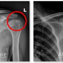 예스병원용인분당점 이미지