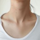 최고의 쥐젖/사마귀 없애는 방법 이미지