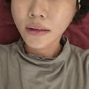 청담진성형외과피부과의원 | 기미 때문에 방문한 청담 피부과, 상담부터 시술까지 만족했던 청담루틴의원 후기