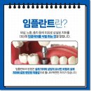 강남부부치과의원 네이버블로그