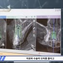덴탈플란트 이미지